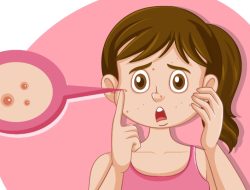Cegah Munculnya Jerawat Haid, Lakukan 9 Tips Ini!